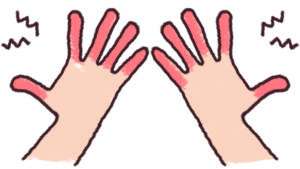 血行障害（しもやけ）